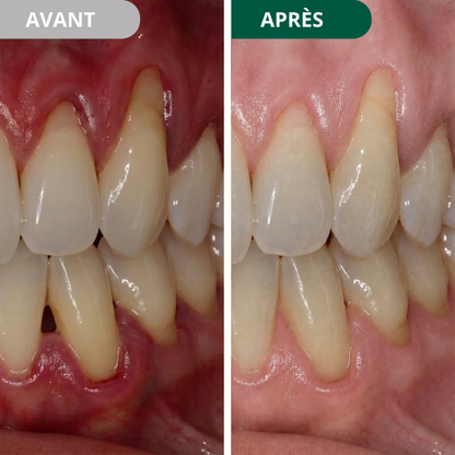 L’essentiel pour vos gencives
